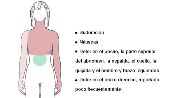 que brazo duele con el infarto que brazo duele con el infarto